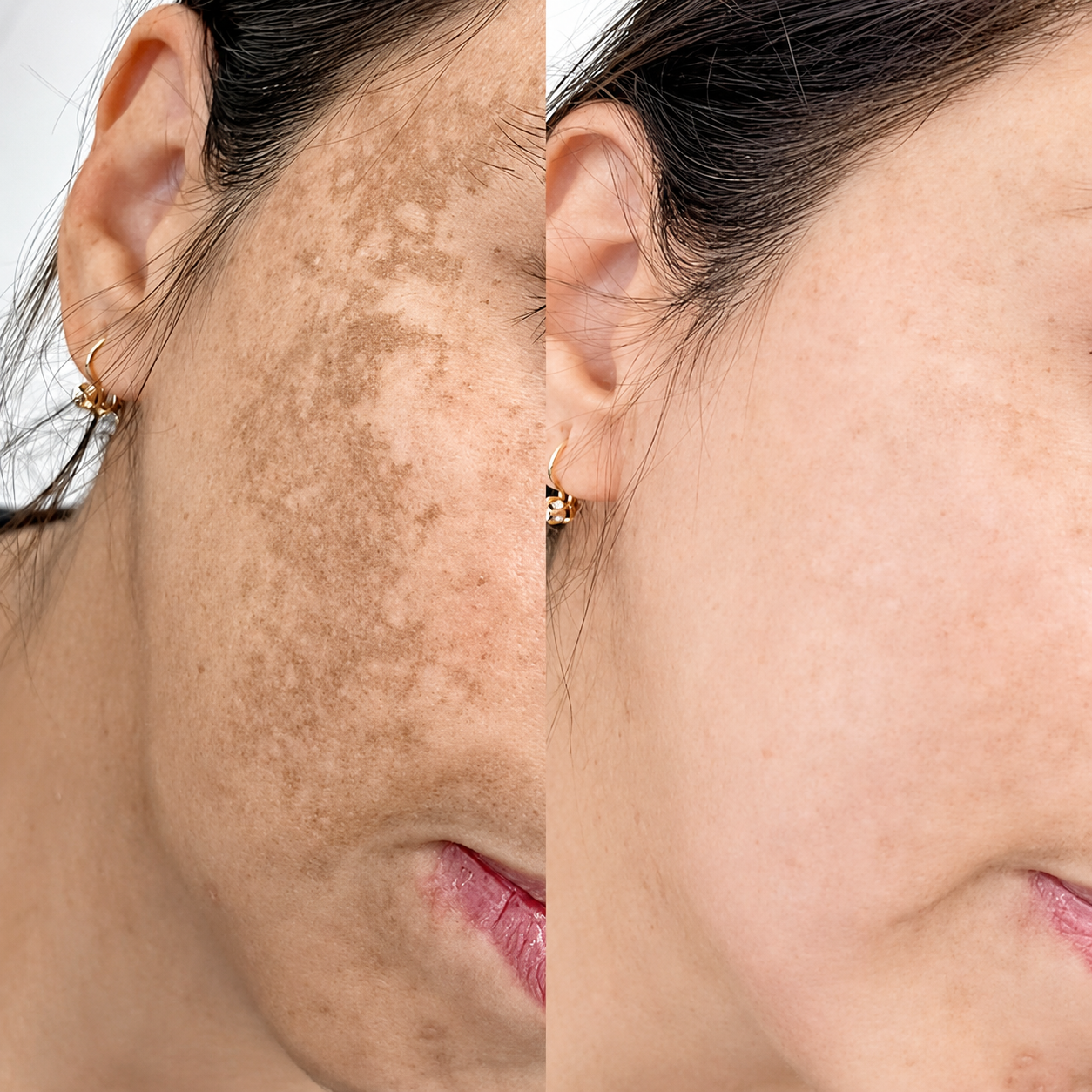 ChatGPT Image Jun 25, 2026, 02_12_49 PM Skin_Peel